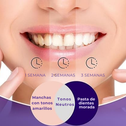 WhiteGlow - Blanqueador Dental Morada v34